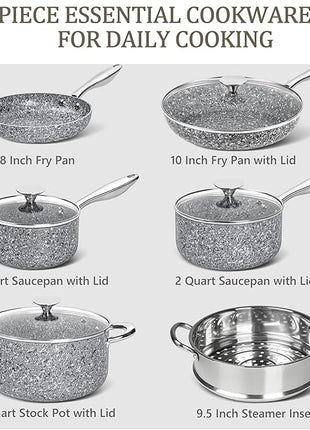 MICHELANGELO Stone Cookware Set 10 Piece, Ultra Nonstick Pots and Pans Set with Granite Coating, Kitchen Cookware Sets, Stone Pots and Pans Set, Granite Pots and Pans Set - 10 Piece