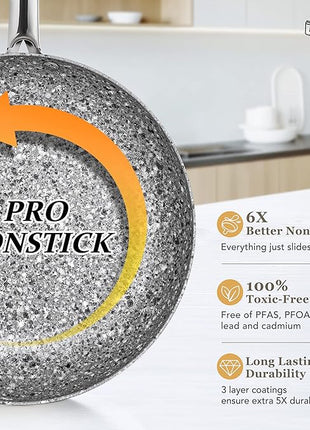 MICHELANGELO Pots and Pans Set 10 Piece, Cookware Set with Granite Coatings for Super Nonstick Result Essential Stone Cookware Sets with Utensil Set, Induction Compatible, PFOA Free